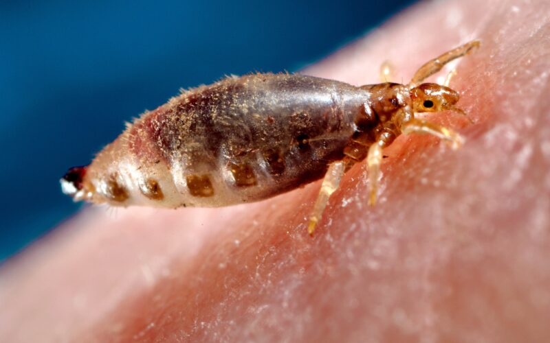 பேன் body louse